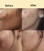 Ceramide Serum & Cream Feedback